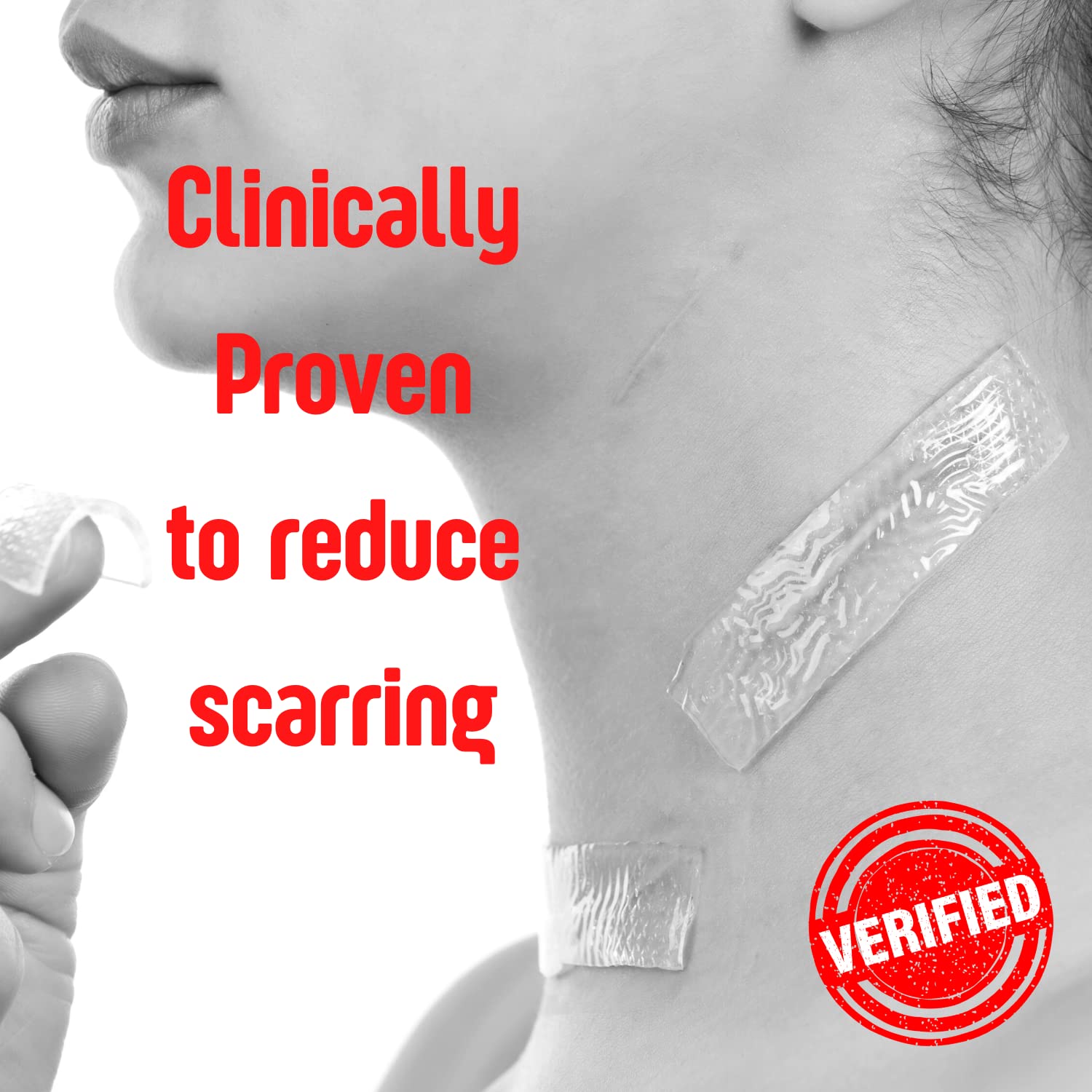Medagel SilverSeal moist gel pad maintains a hydrated wound environment.