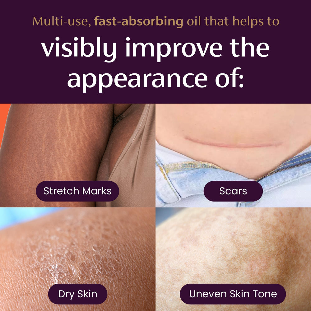 Mederma Coconut Oil seals in hydration for lasting softness