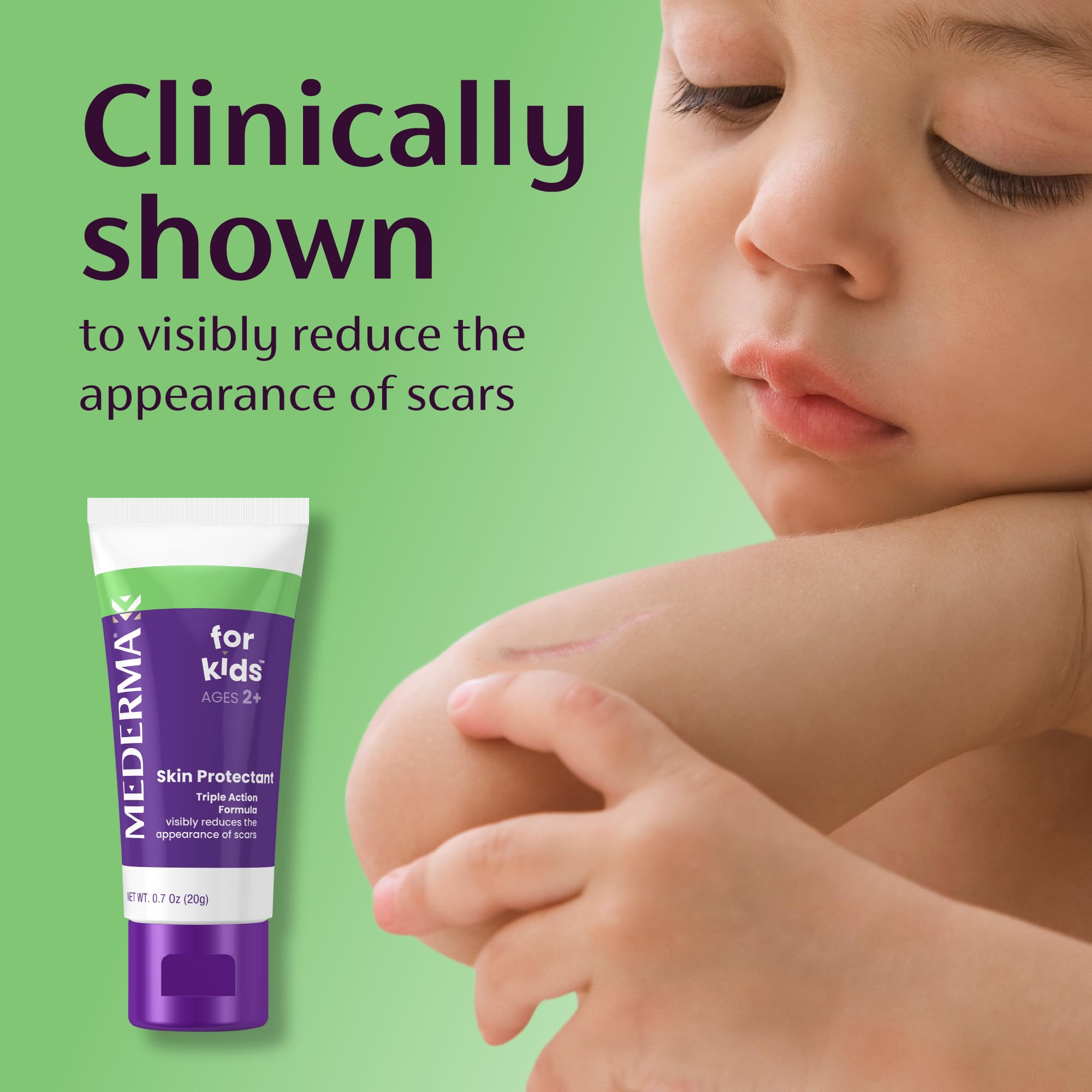 Mederma Kids pediatrician trust image reinforces safe scar care for children.