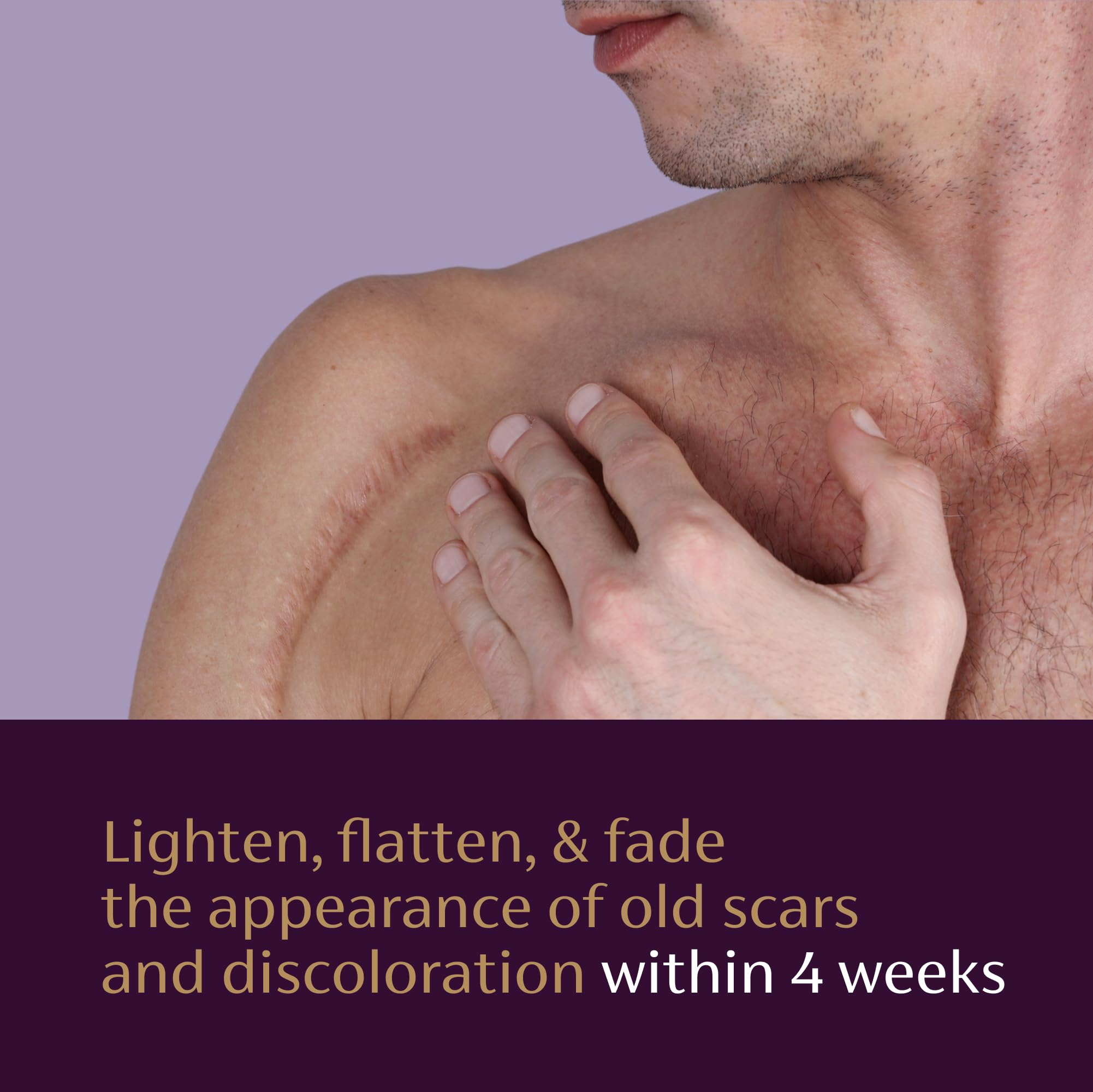 Mederma Scar Serum label emphasizes clinically shown results