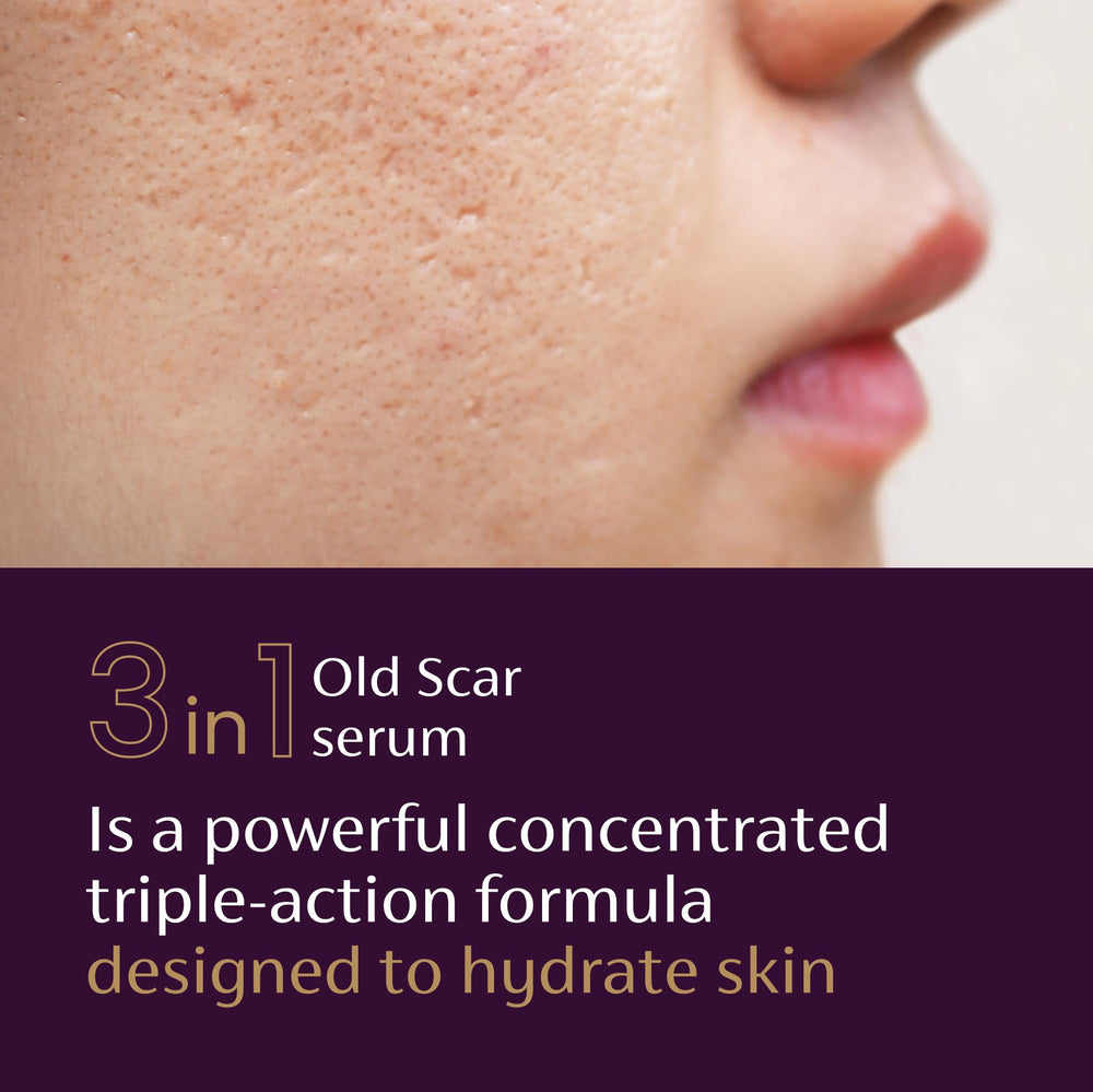 Mederma Scar Serum pump applicator used on forearm