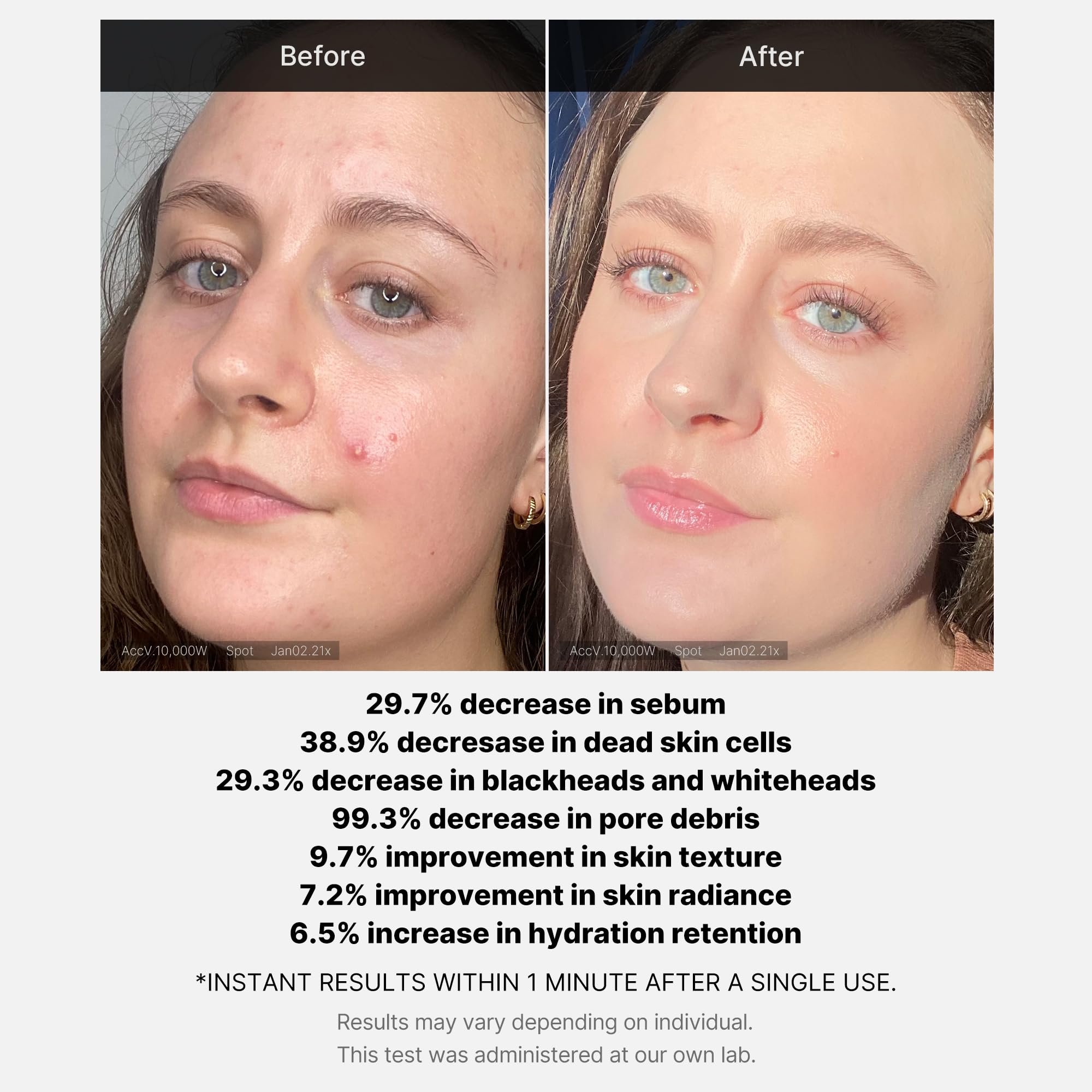 Medicube Hydra Calm and Derma-Clera soothe irritation during use.