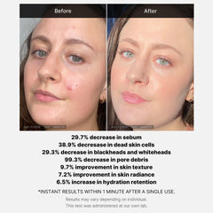Medicube Hydra Calm and Derma-Clera soothe irritation during use.