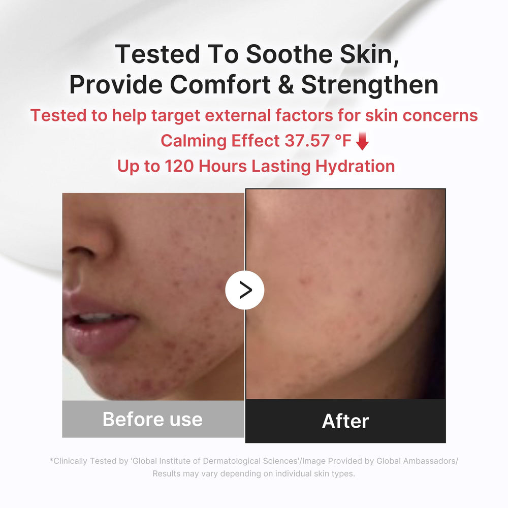 Medicube 3H Daily Relief Cream ingredients illustration highlights guaiazulene and centella