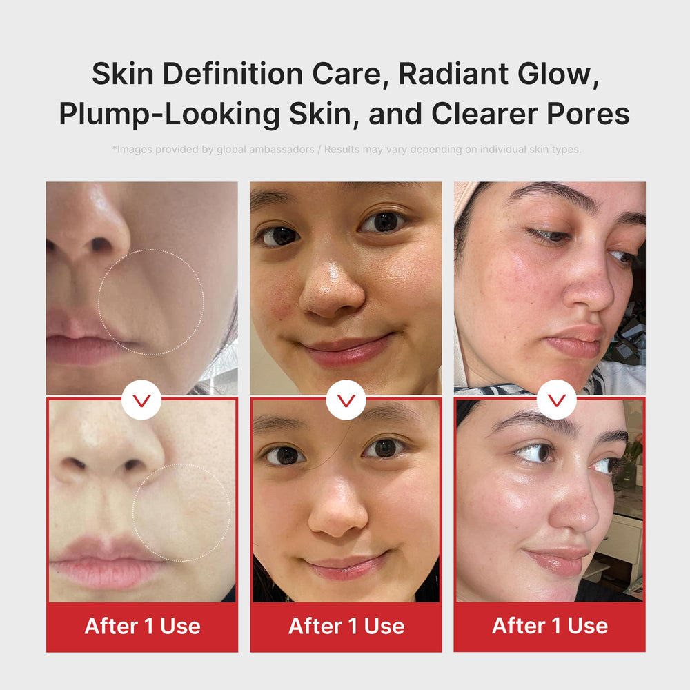 Medicube Booster Pro pore care demo during facial massage.