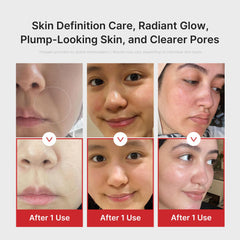 Medicube Booster Pro pore care demo during facial massage.