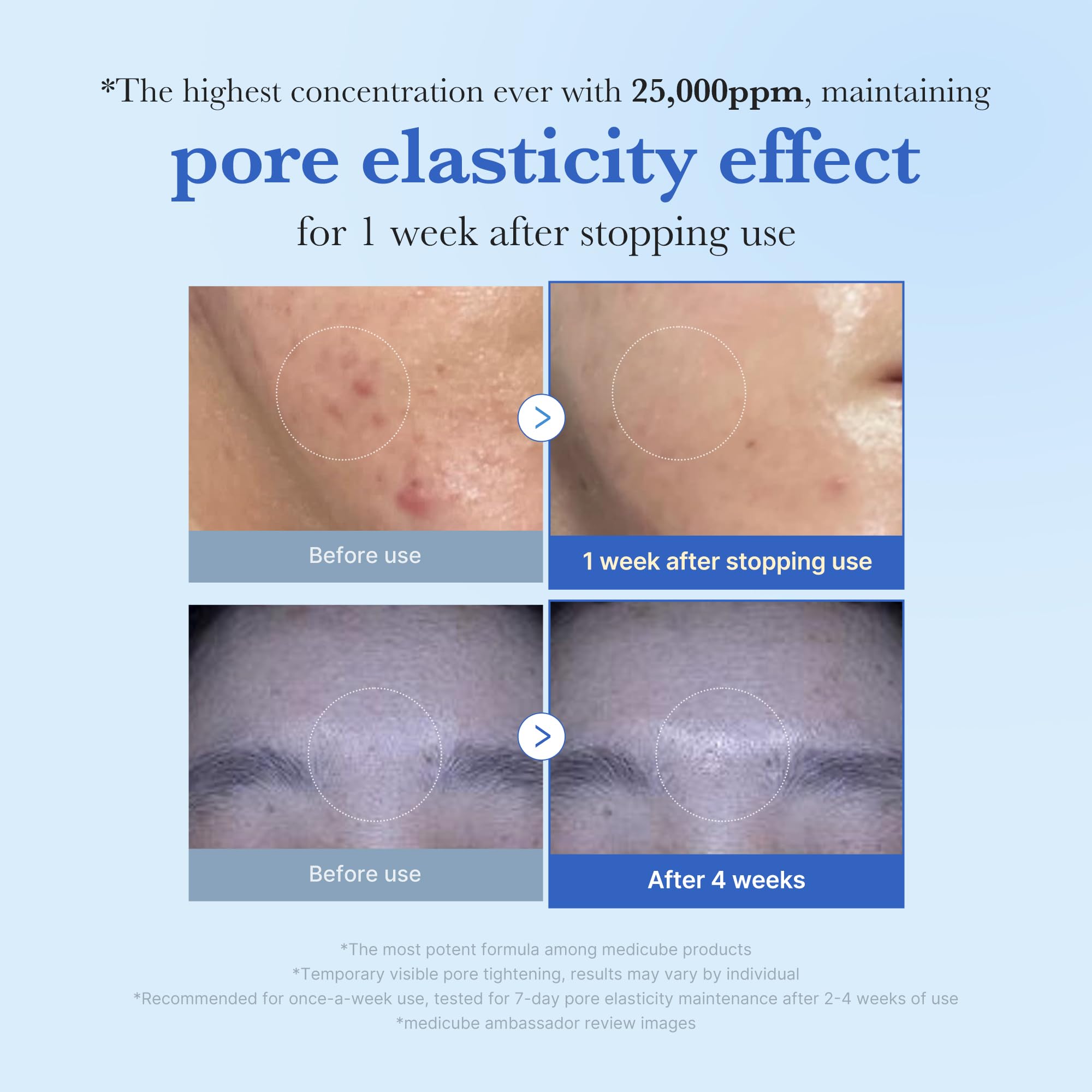Medicube Exosome Shot Zero bottle close-up highlighting premium skincare