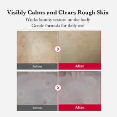 Application on shoulder using Medicube Red Body Peeling Shot for targeted exfoliation.