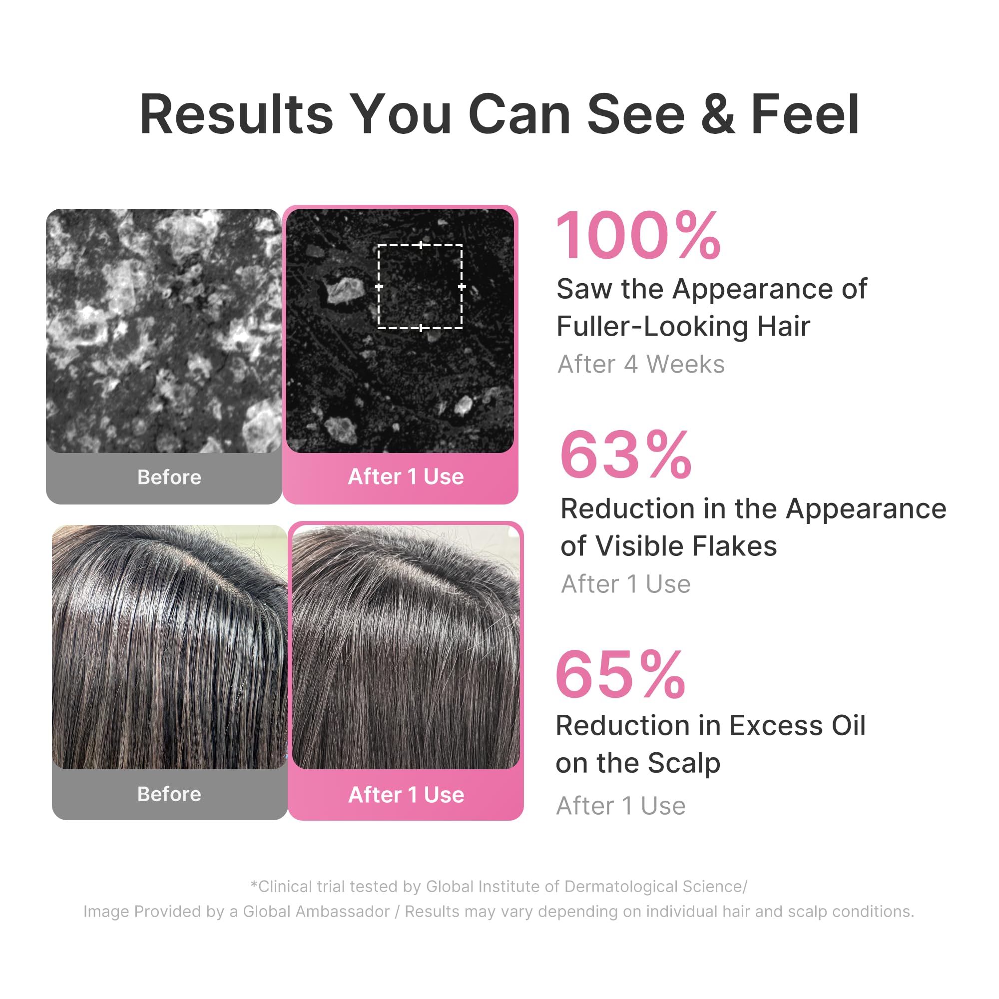 Medicube Rosemary PDRN Clarifying Shampoo scalp relief closeup emphasizes soothing care.