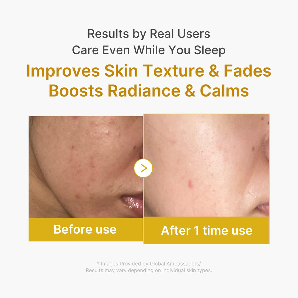 Medicube Wrapping Mask peel-off action reveals refreshed, glowing skin in the morning.