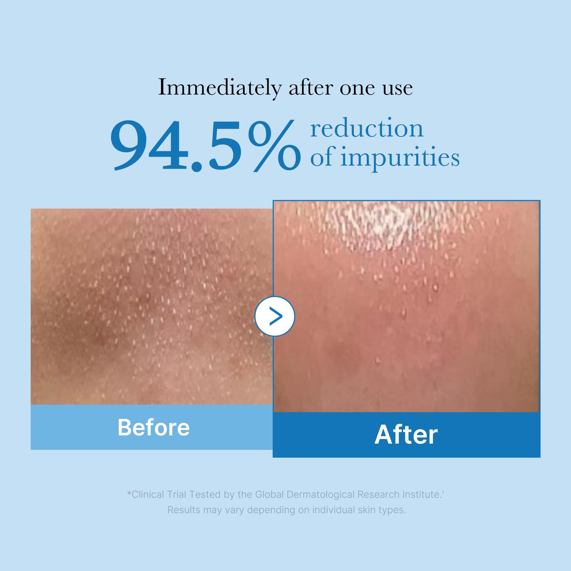 Medicube Zero Pore Cleansing Oil emulsifies into milk for easy rinse
