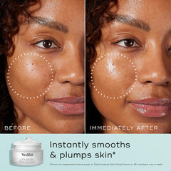 Medik8 Total Moisture jar being opened suggests plump, hydrated skin.