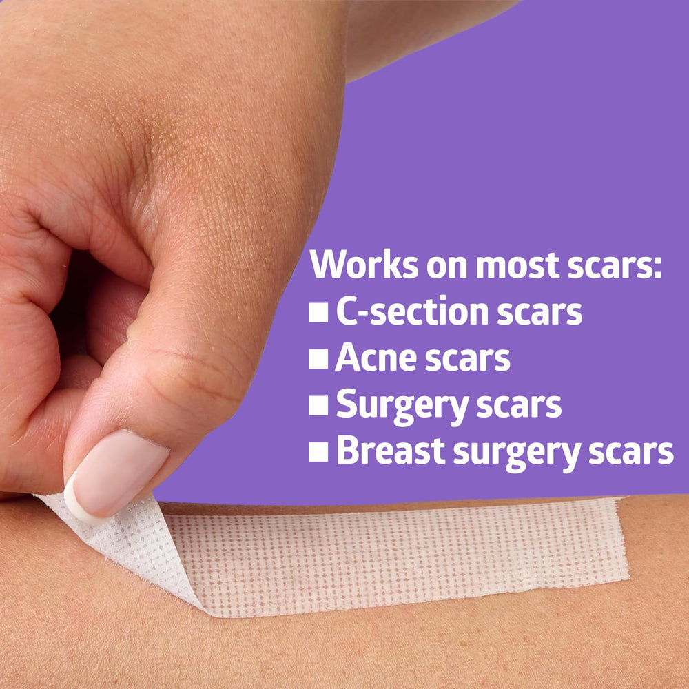 Gentle removal shown as tape peels away smoothly.
