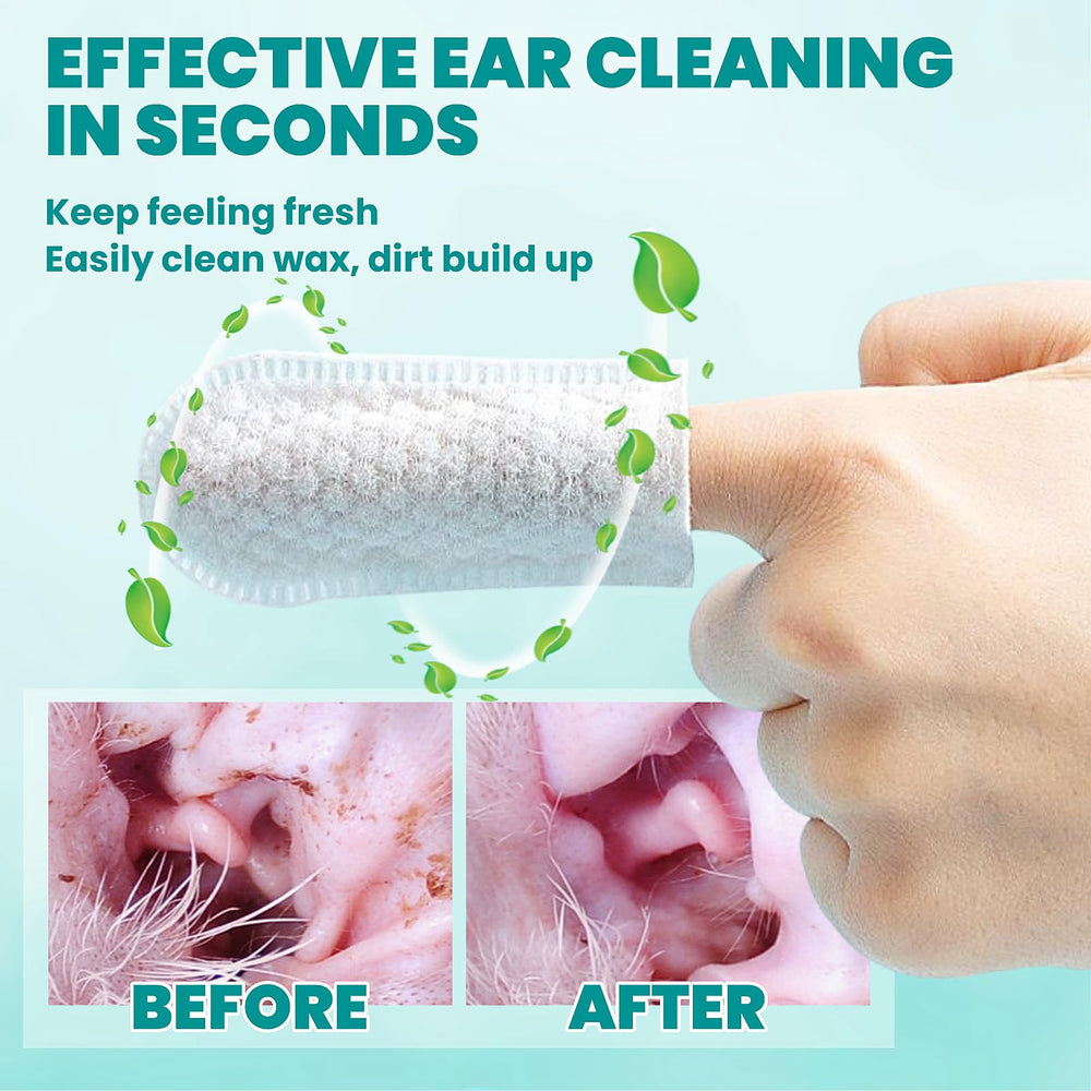 MEDUWEDU ear cleaner finger wipes natural plant formula is non-irritating
