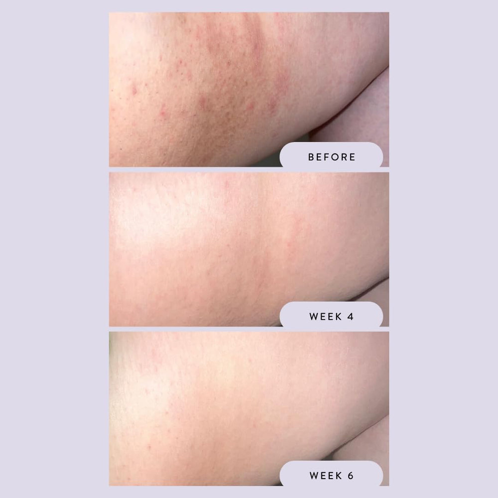 Megababe Night Rescue application on arm illustrates even tone benefits.