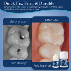 Meldclb dental kit components laid out for easy at-home repairs