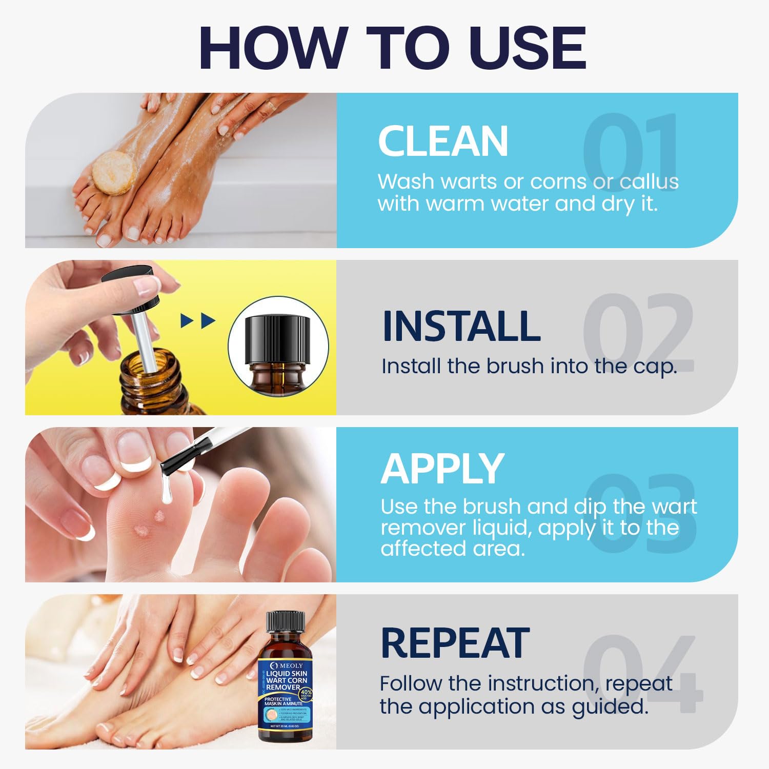 MEOLY freeze-off action application shows rapid wart surface treatment when used properly.
