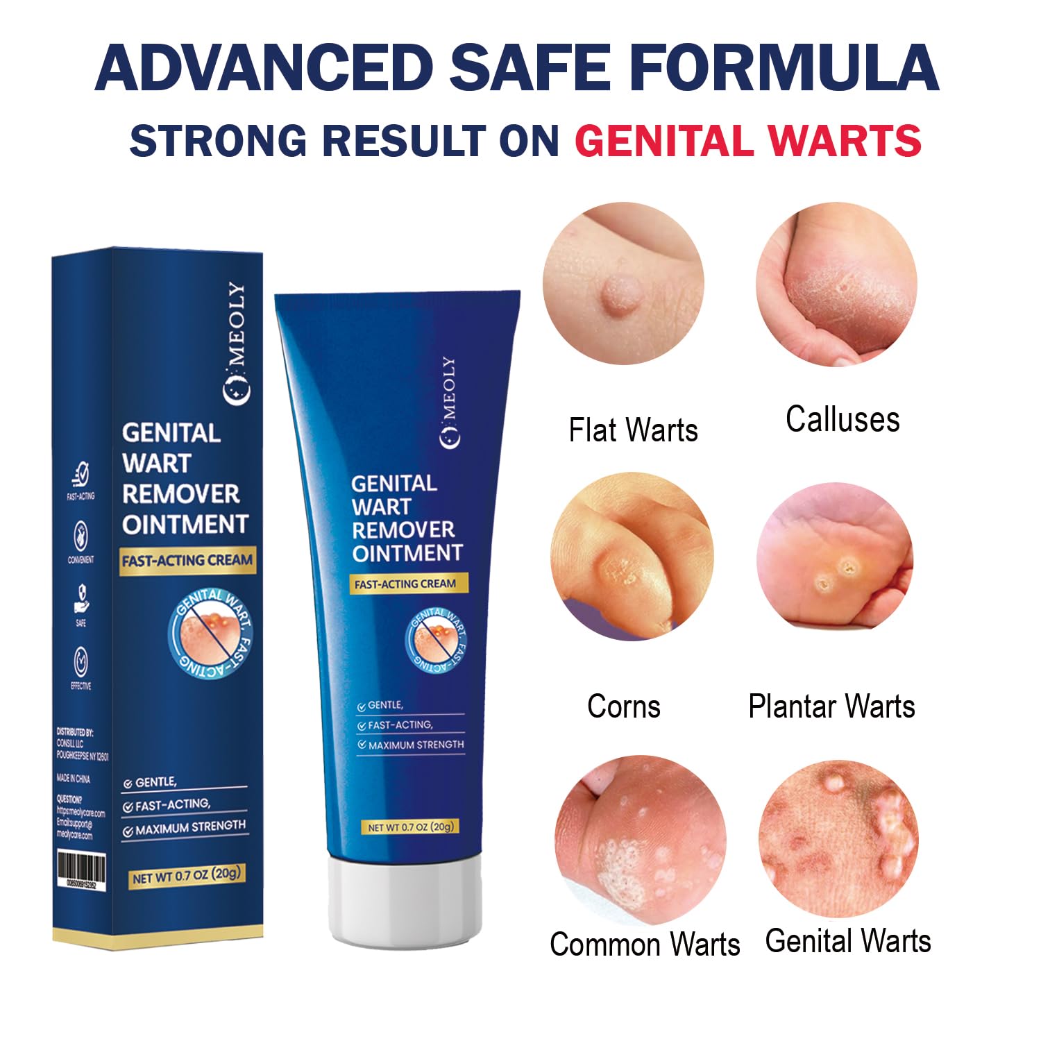 MEOLY genital wart remover cream texture photo demonstrates smooth ointment ready to apply.