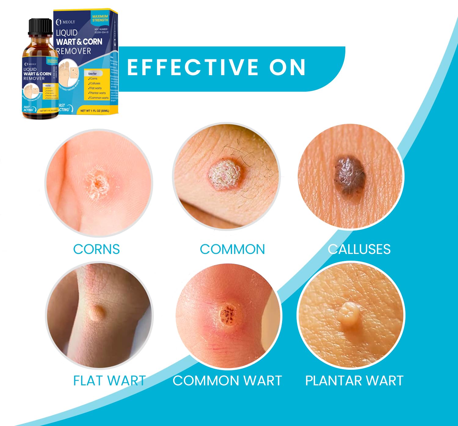 MEOLY salicylic wart removal bottle label shows strength.