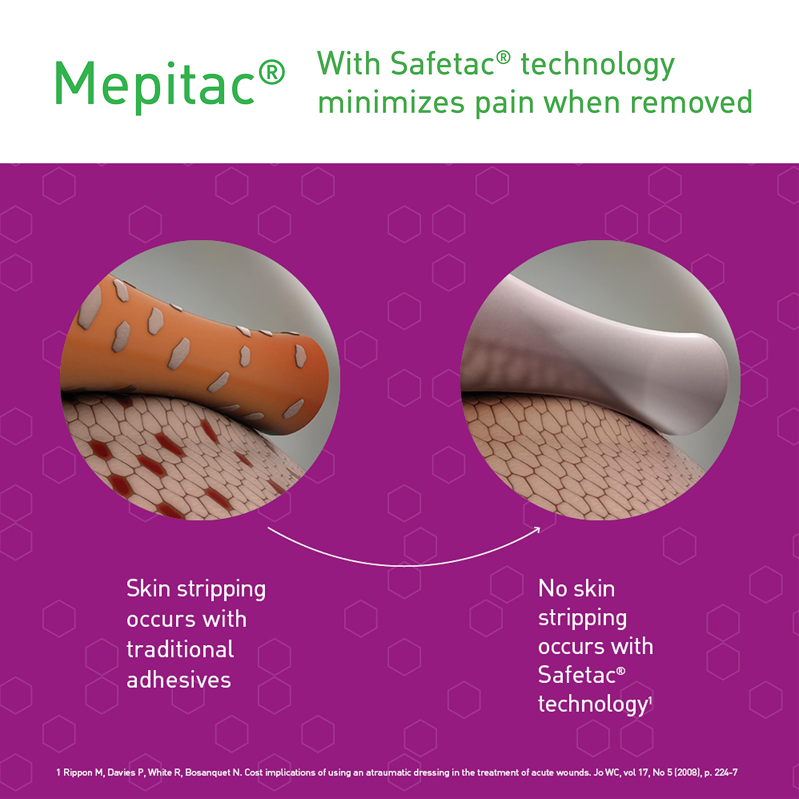 Mepitac Soft Silicone Tape close-up edge highlights smooth removal