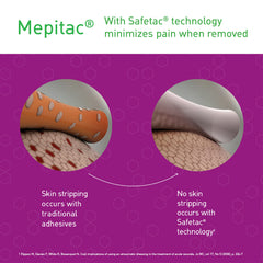 Mepitac Soft Silicone Tape close-up edge highlights smooth removal