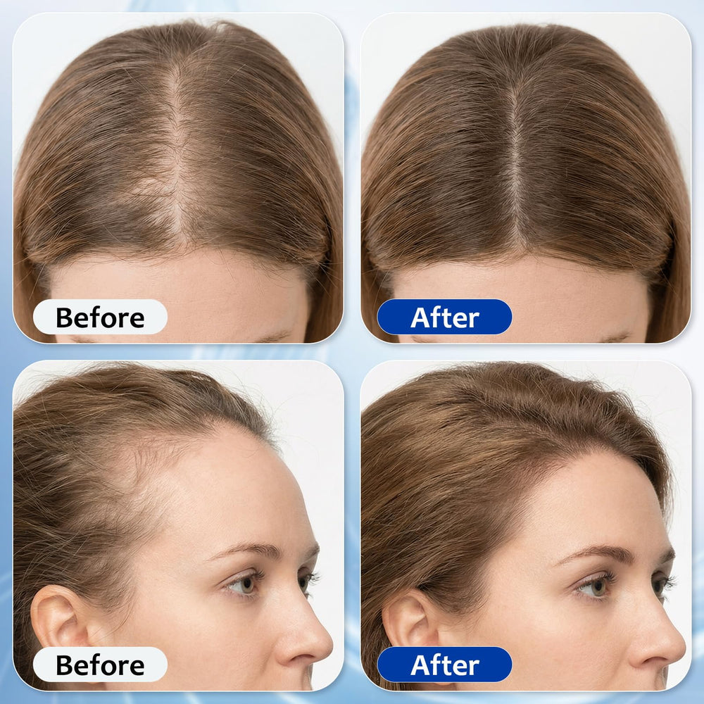 MGVAASURC Hair Growth Serum Roll-On ginger root oil improving scalp comfort