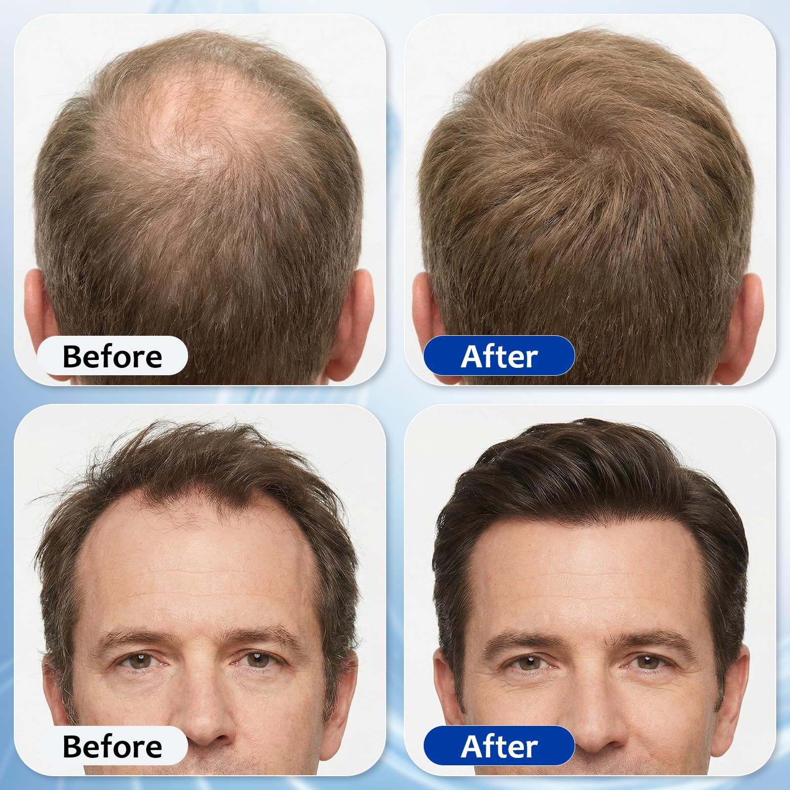 MGVAASURC Hair Growth Serum Roll-On stainless steel roller for precise application