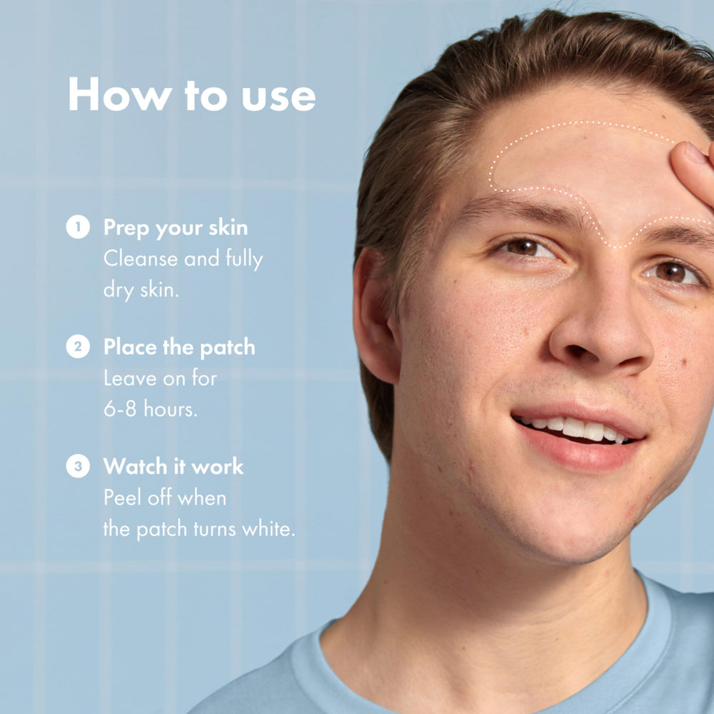 Mighty Patch Forehead creates a protective barrier to discourage picking