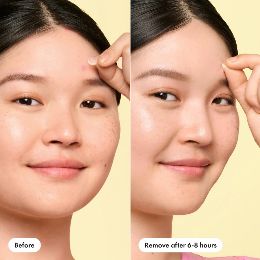 Mighty Patch Mini ultra-thin patch creates a barely-there look on skin.