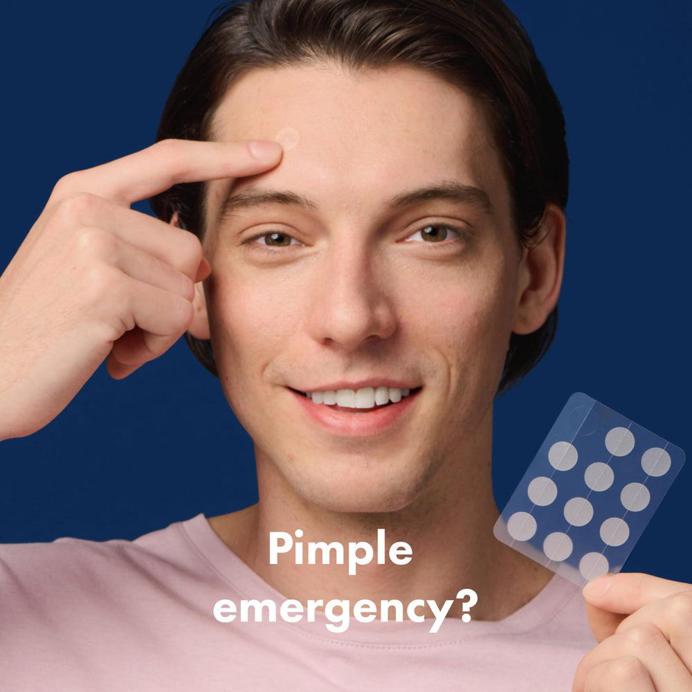 Mighty Patch Original on whitehead demonstrates rapid absorption of pimple gunk overnight.