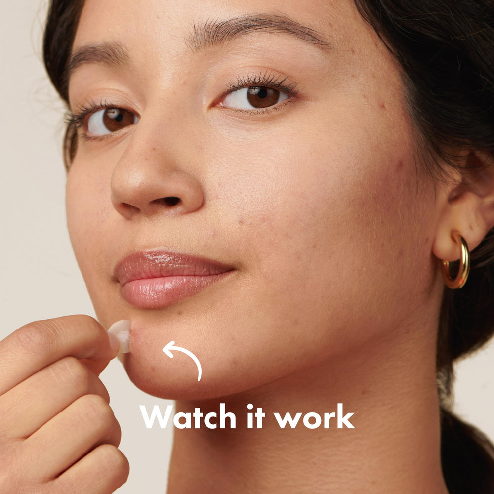 Mighty Patch Original overnight adhesion stays through sleep without irritation.
