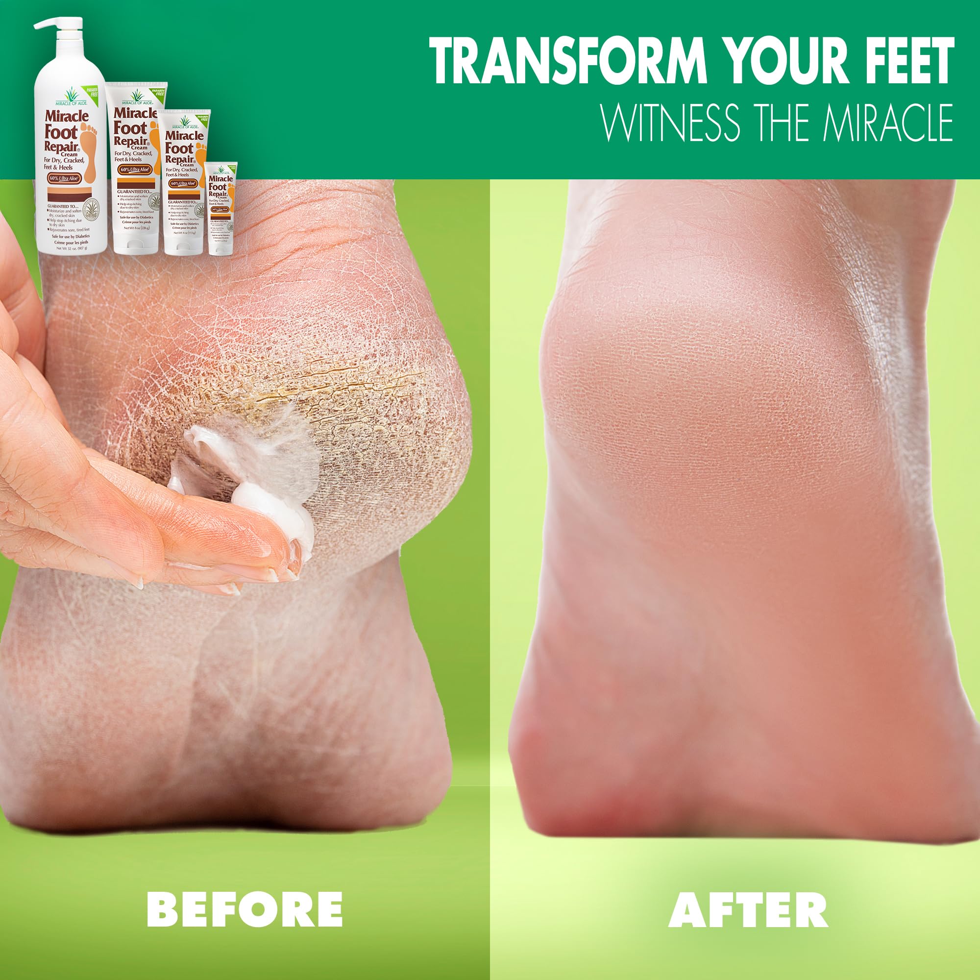 Miracle of Aloe Foot Repair Cream pack showcases value with 2-pack convenience for ongoing care