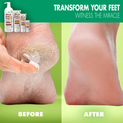 Miracle of Aloe Foot Repair Cream pack showcases value with 2-pack convenience for ongoing care