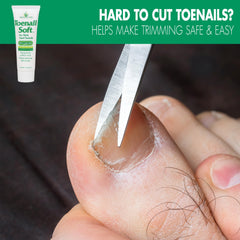 Miracle of Aloe toenail softener Cream application shows even coverage for thick nails.