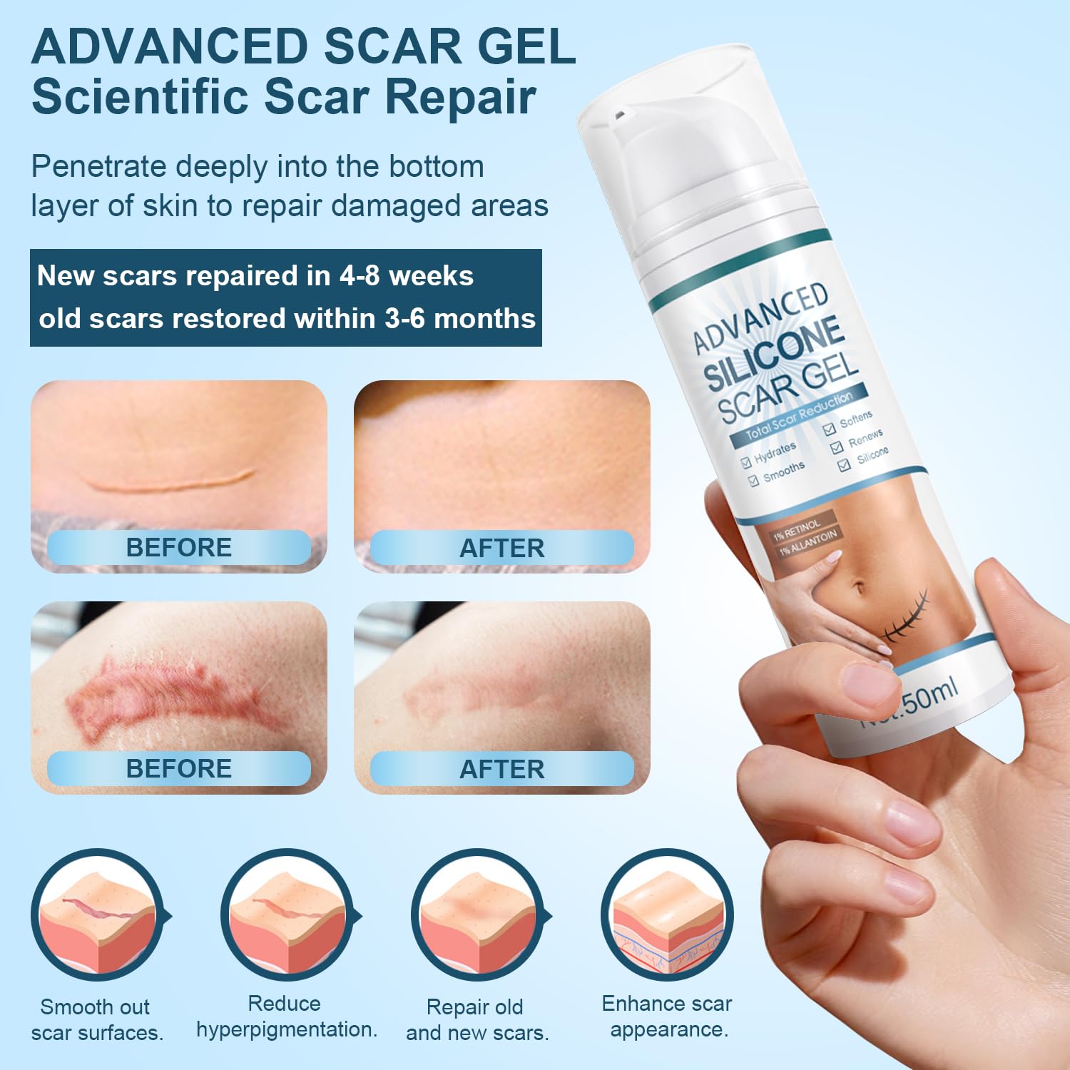 Mitgary Advanced Scar Gel for facial application helps even skin tone and smoothness.