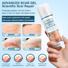 Mitgary Advanced Scar Gel for facial application helps even skin tone and smoothness.