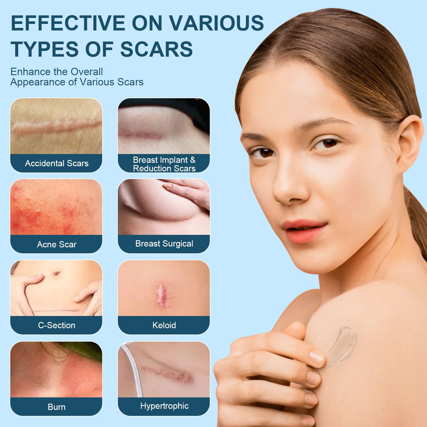 Mitgary Advanced Scar Gel close-up shows quick-absorbing formula with soothing feel.