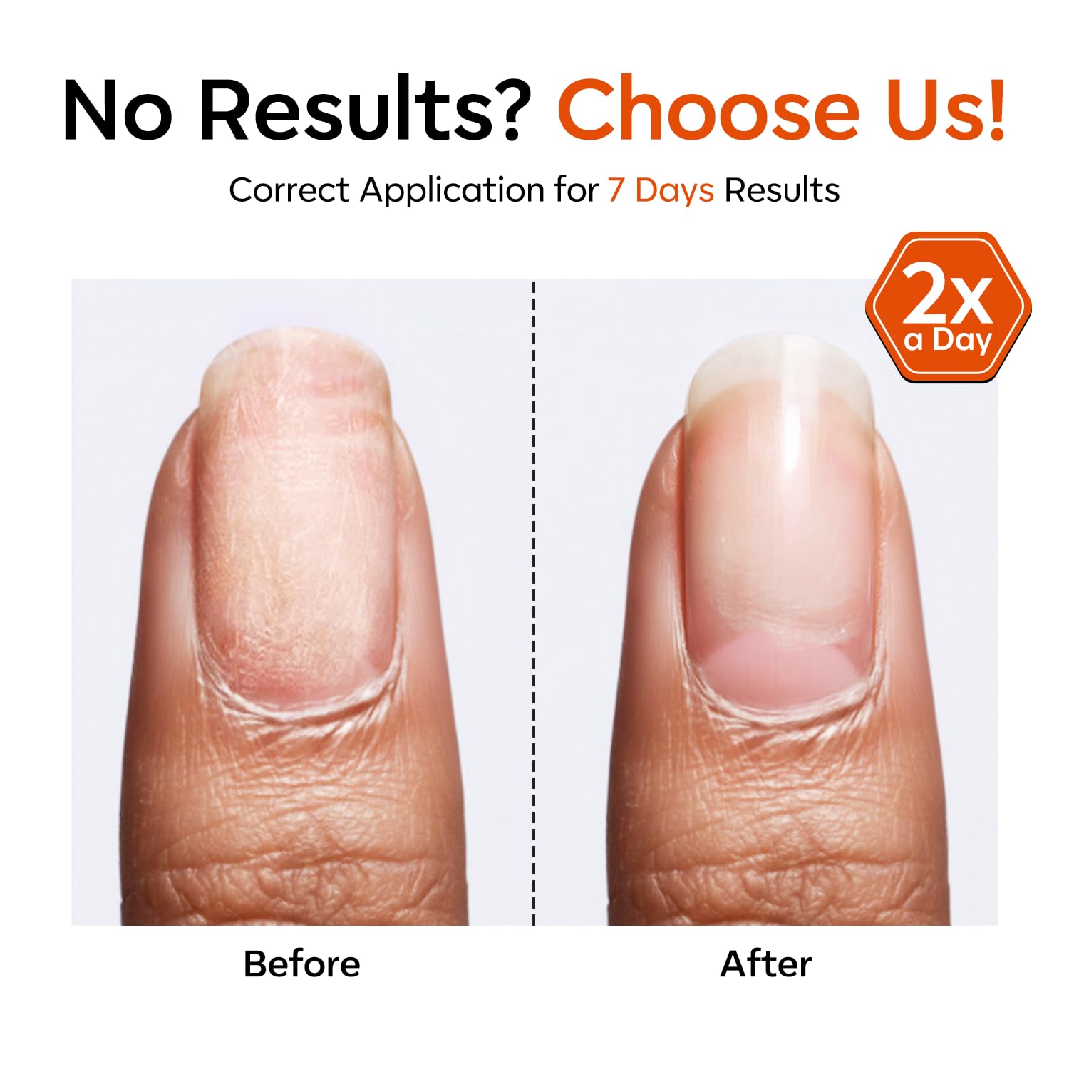 Modelones formula with keratin and jojoba nourishes nails.