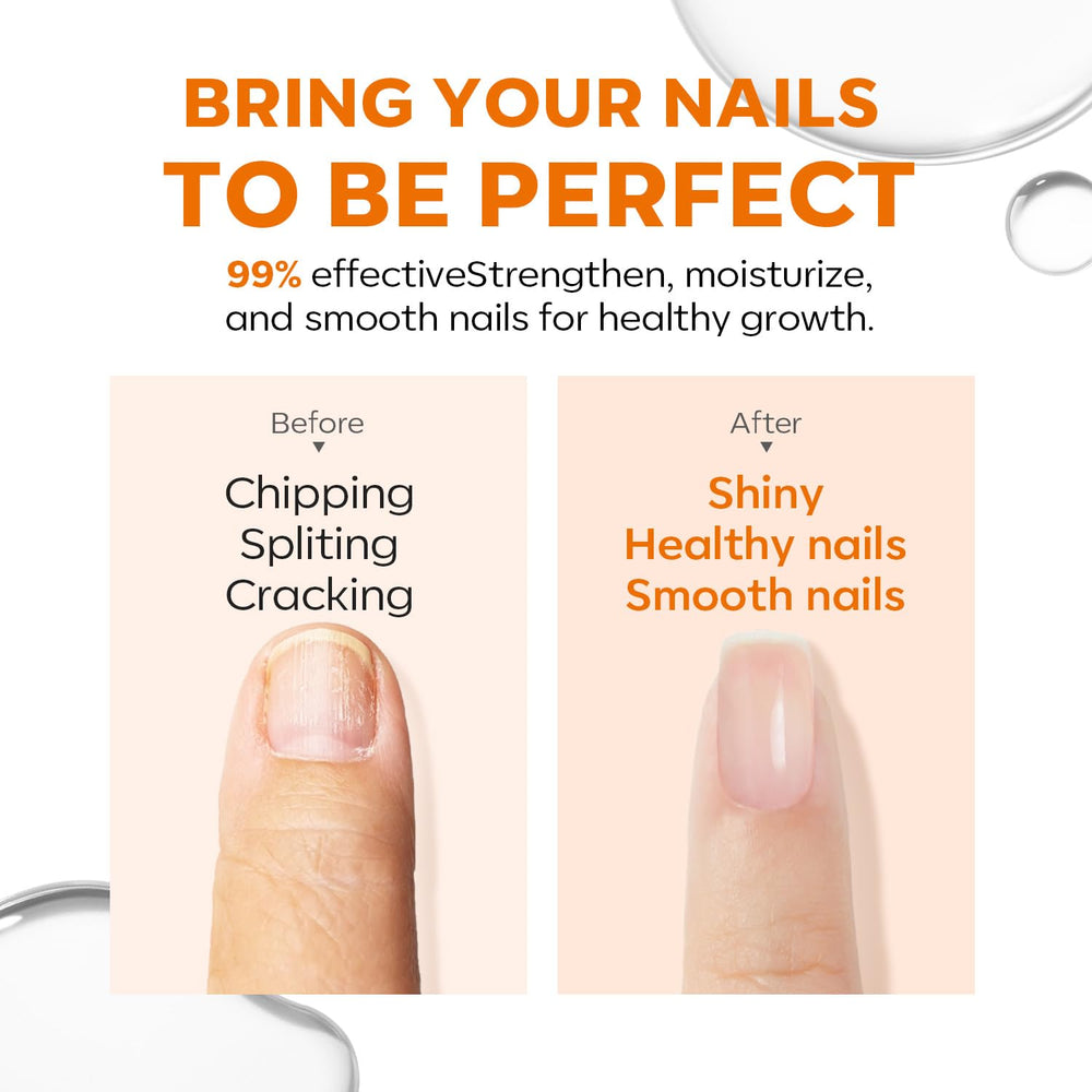 Modelones-ridge-filler-nail-smoothing smooths ridges for a sleek, uniform surface.