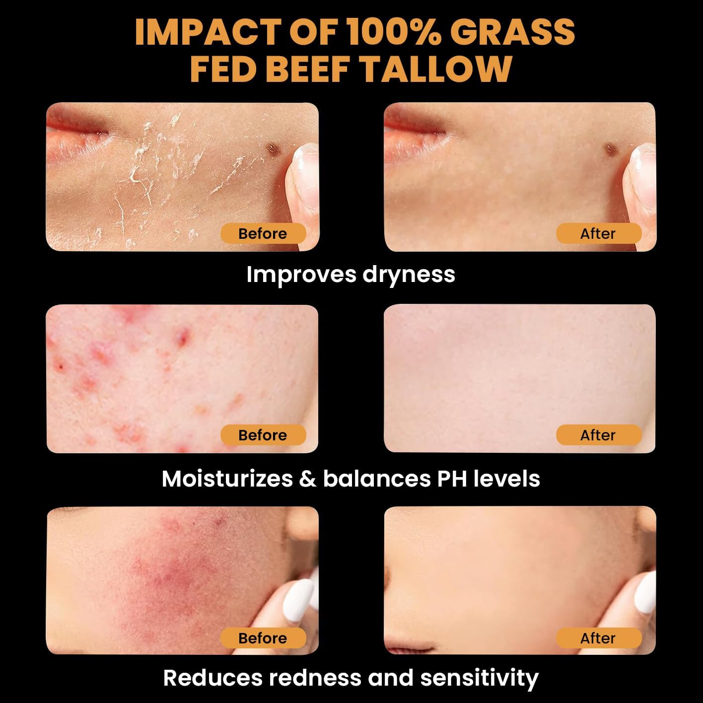 MONIER balm texture demonstrates nourishing feel for dry skin