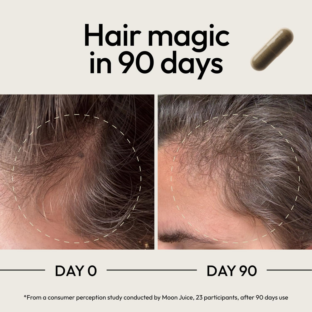 Moon Juice SuperHair capsules close-up revealing micronutrients