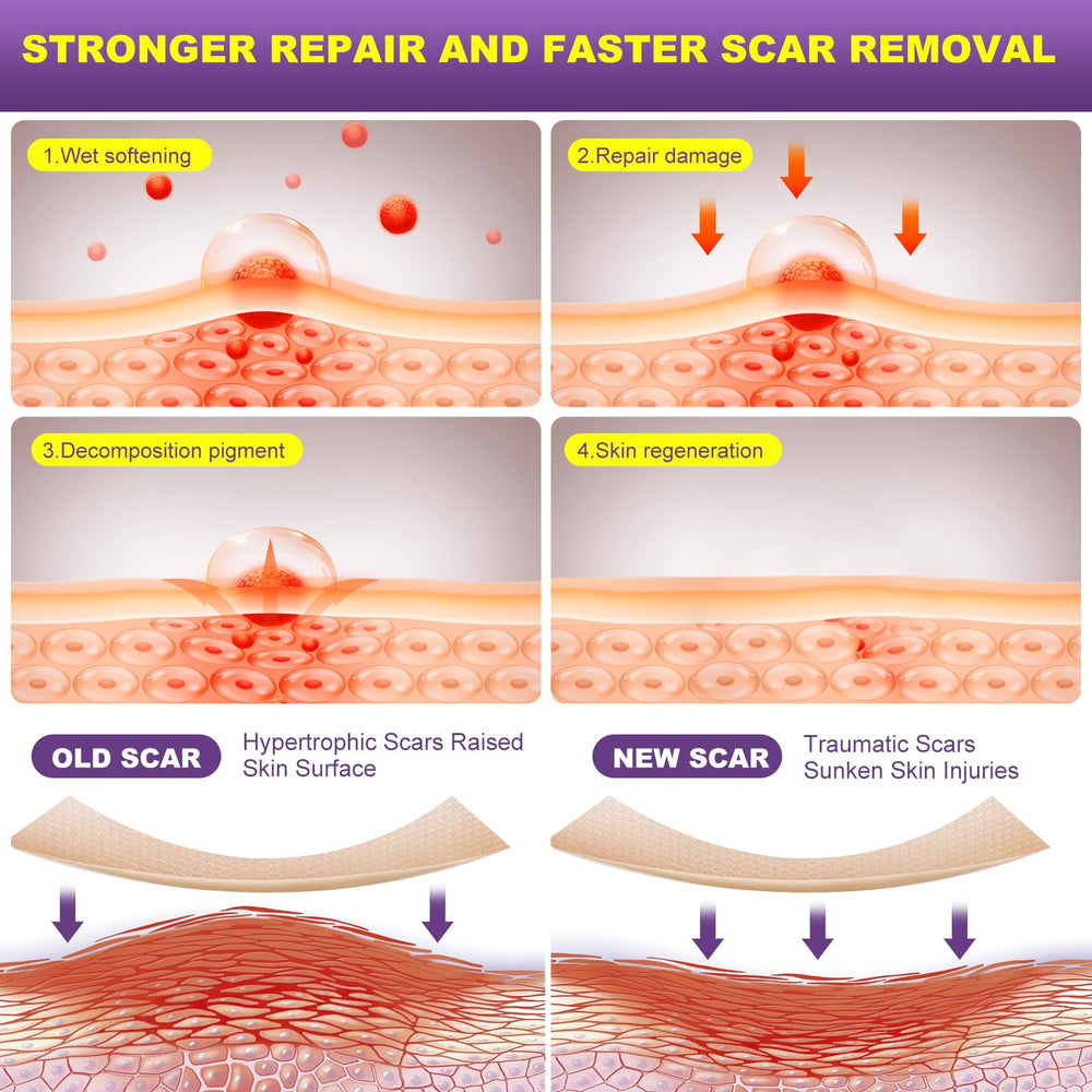 MUKBEA scar strip on keloid bump area with smooth, flexible silicone.
