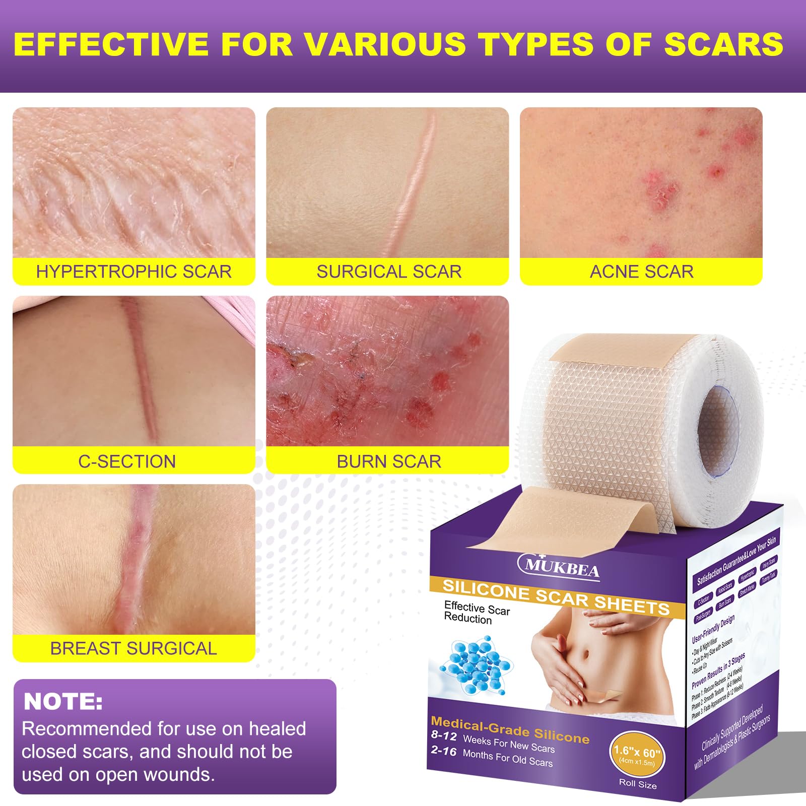 MUKBEA silicone scar tape applied to skin for gentle, breathable scar protection.
