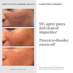 Murad Acne Control Clarifying Cleanser encapsulated salicylic acid beads continue to work after rinse
