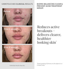 Murad Biome-Balancing Serum drop dispenses a precise bead.