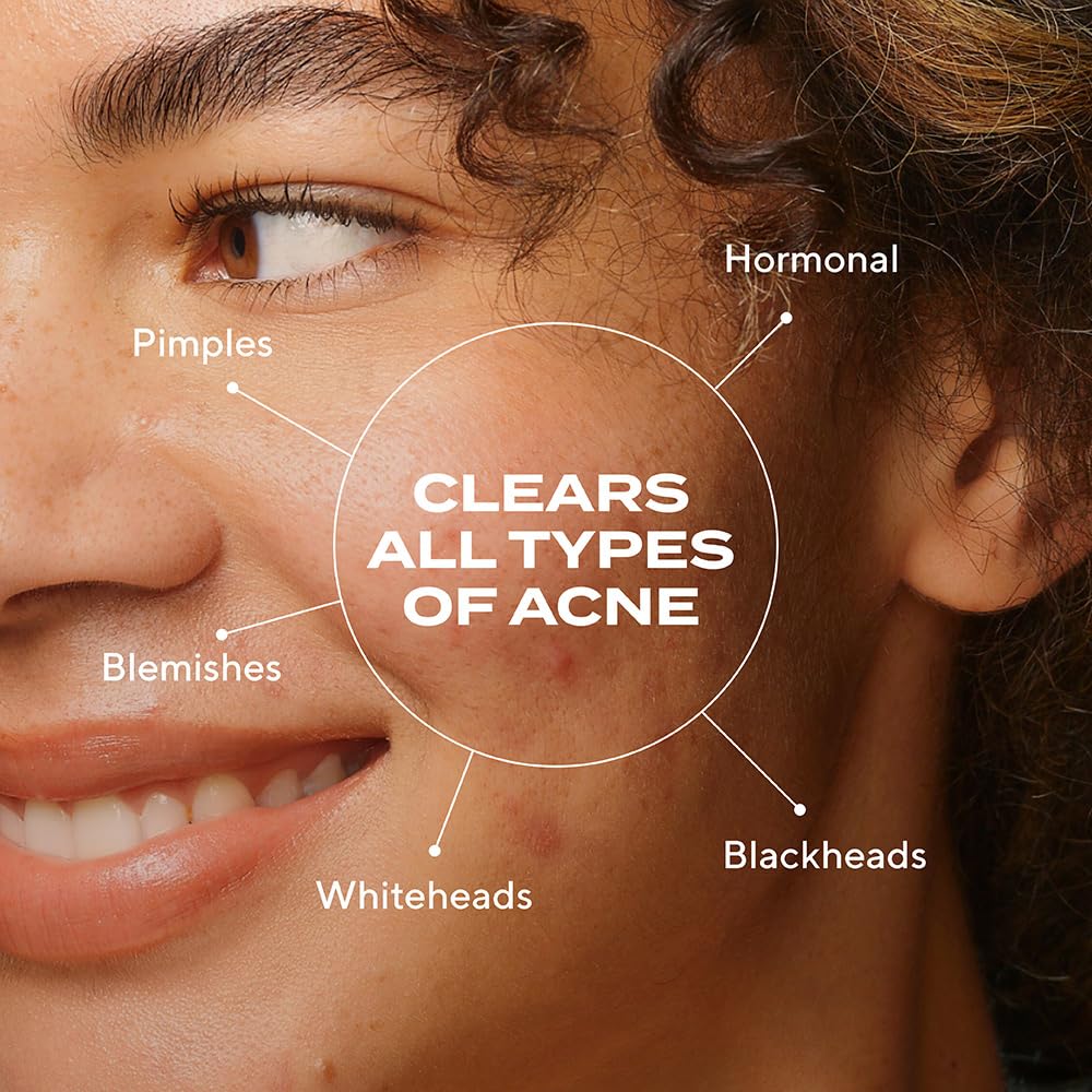 Murad Biome-Balancing Serum dropper cap shown for precise dosing.