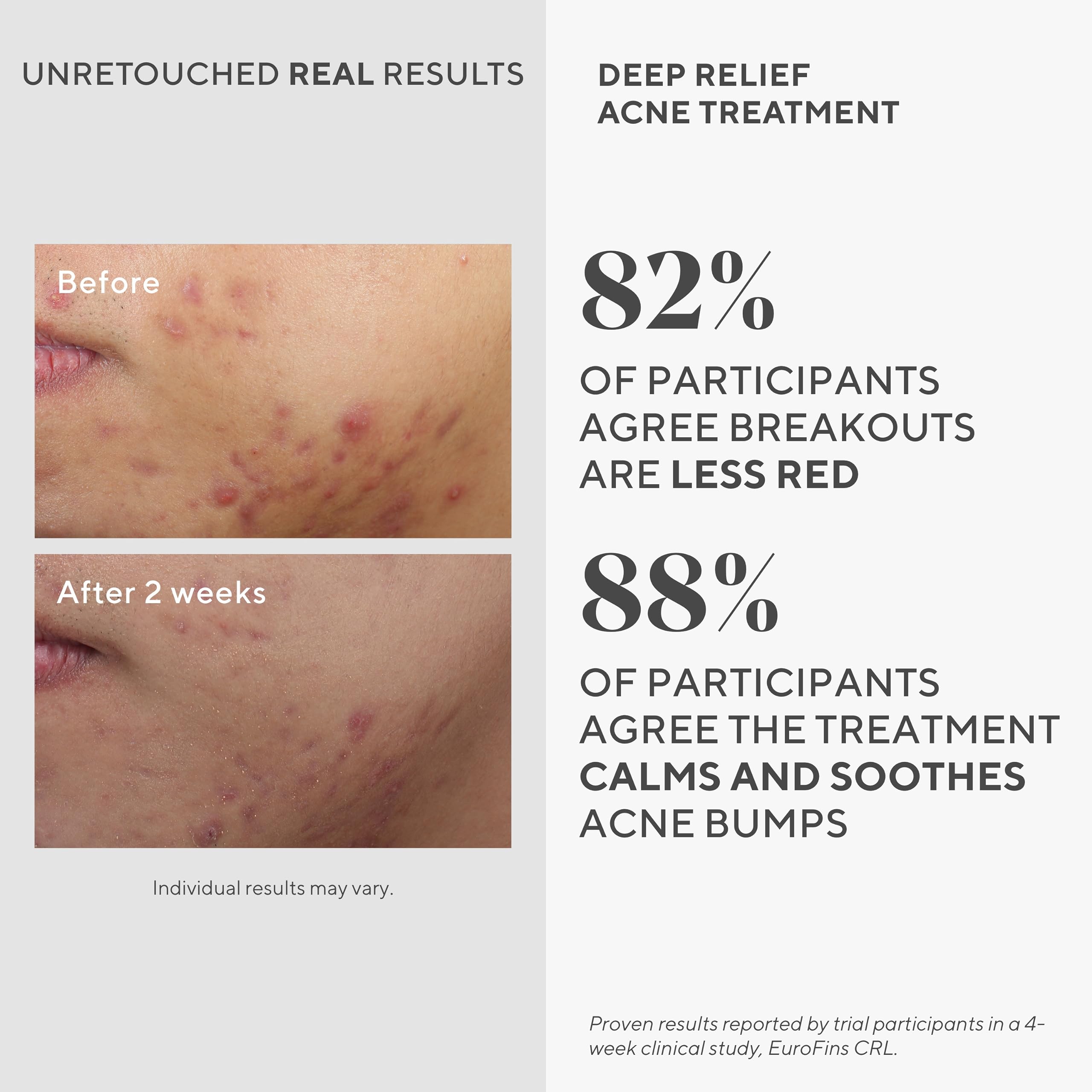 Easy to use daily spot treatment in Murad routine