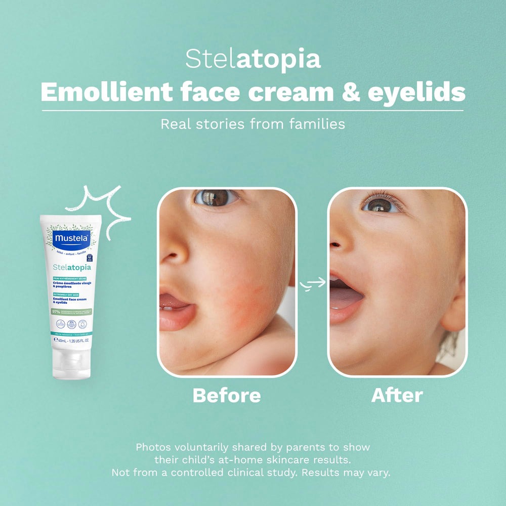 Mustela Stelatopia fragrance-free packaging communicates gentle care