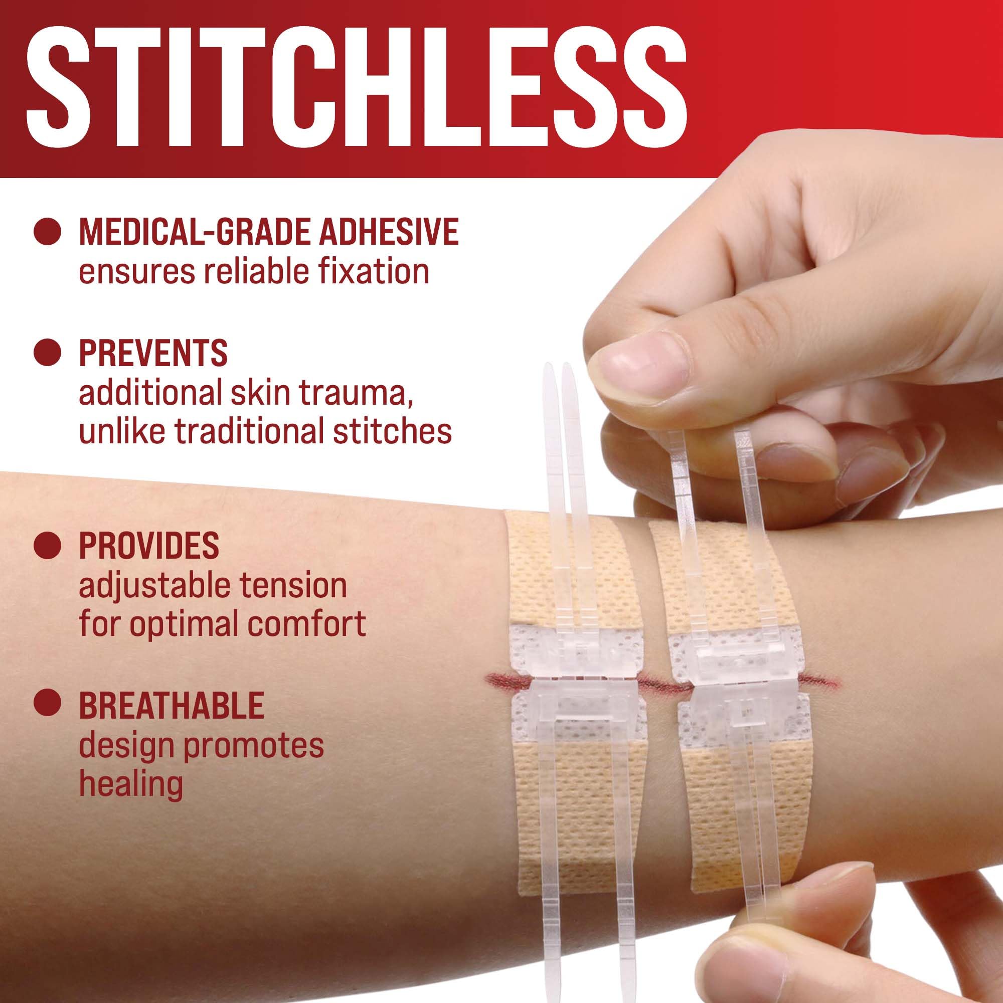 MYHELP two-size closure strips cover minor to serious lacerations