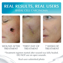 Applying the gel on a scar highlights quick-dry texture.